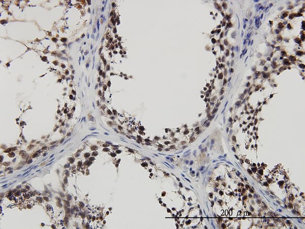 PBK / TOPK Antibody (clone 1E11)