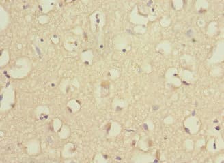 Polyclonal Rabbit anti-Human RPS27 / Ribosomal Protein S27 Antibody (IHC, WB)