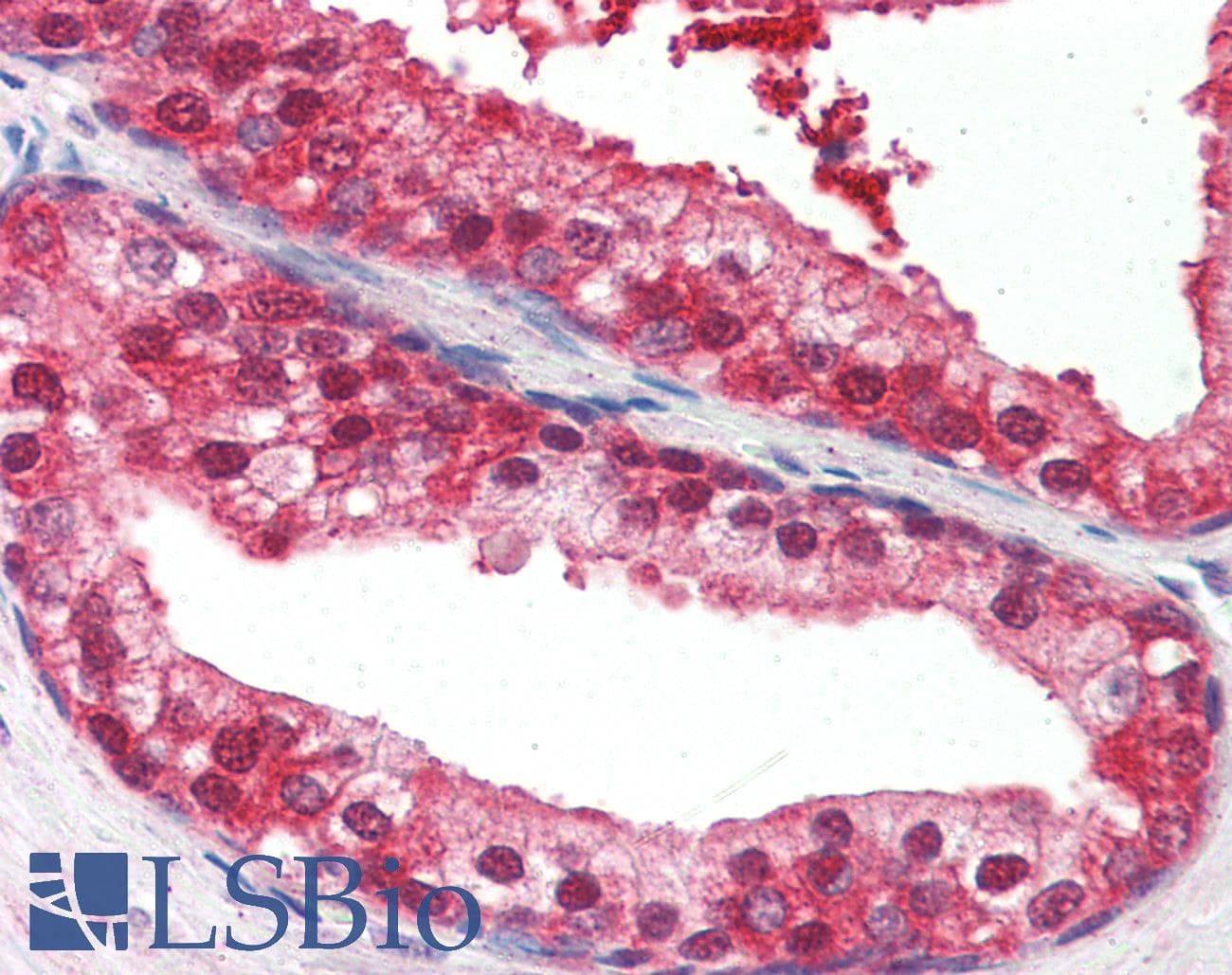 IHC-plus™ Monoclonal Mouse anti-Human UBQLN1 / Ubiquilin Antibody (clone 3D5E2, Internal, IHC, WB)
