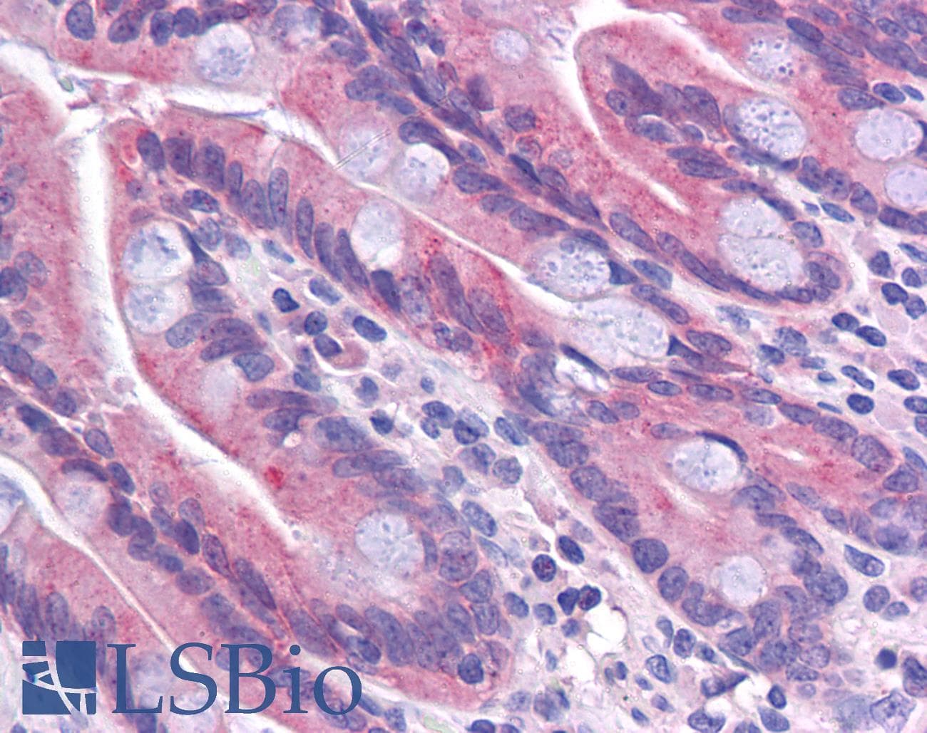 IHC-plus™ TMEM70 Antibody