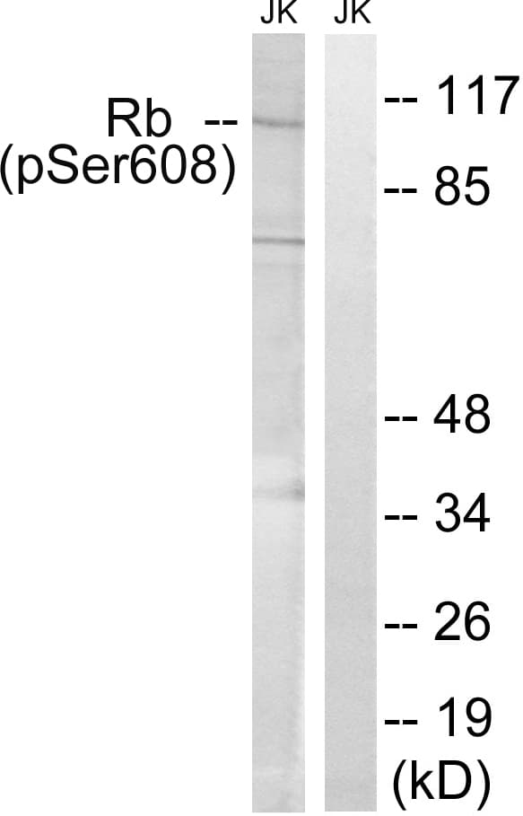 RB1 / Retinoblastoma / RB Antibody (phospho-Ser608)