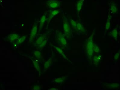 BAZ2B Antibody