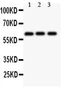 PRF1 / Perforin Antibody (aa175-555)