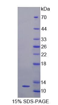 Human GTF2H5 Protein (Recombinant)