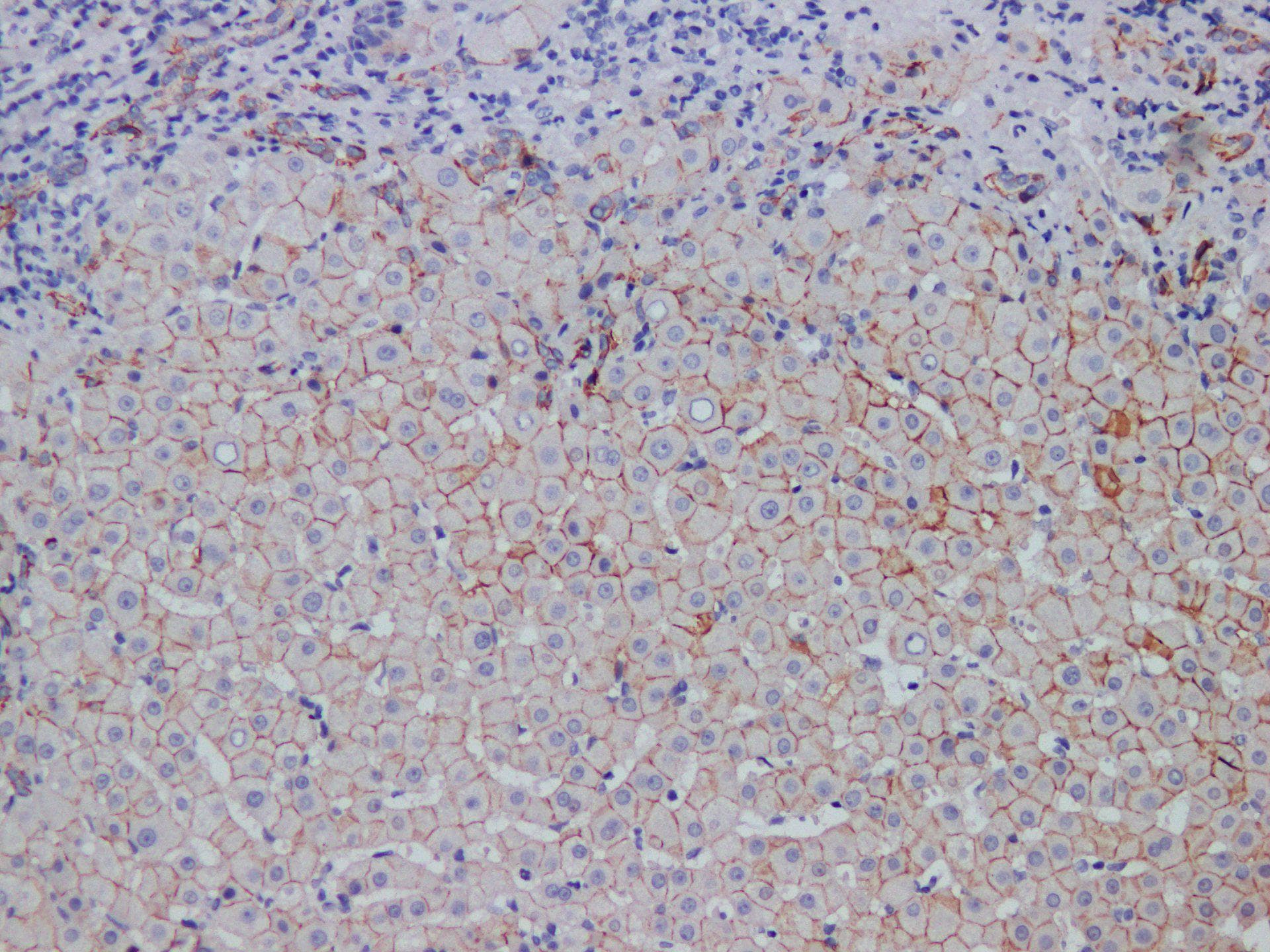 Cadherin Antibody