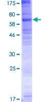 Human SLC35F1 Protein (Recombinant GST)