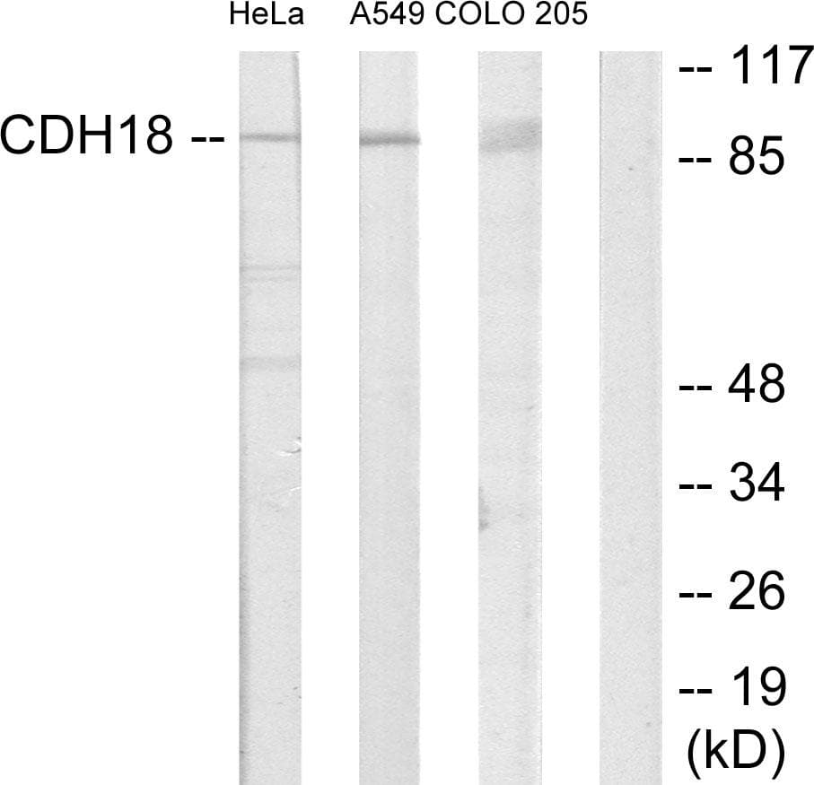 CDH18 / Ey-Cadherin Antibody