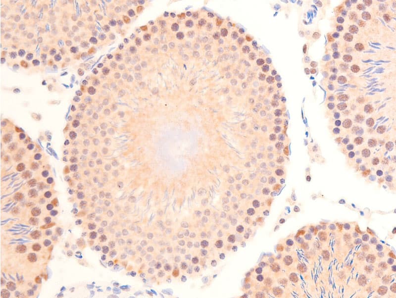 TP53 / p53 Antibody (phospho-Ser392)