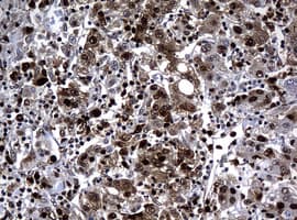 PCNA Antibody (clone OTI6B6)