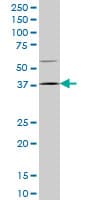 HOXD9 Antibody (clone 2A9)