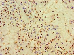 Polyclonal Rabbit anti-Human CFD / Factor D / Adipsin Antibody (aa26-253, IHC)