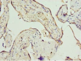 ZDHHC17 Antibody