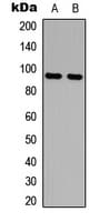 AMPD2 Antibody (Internal)
