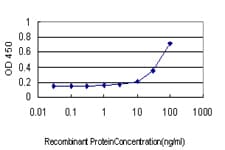 IHC-plus™ CHEK2 / CHK2 Antibody (clone 4B7)