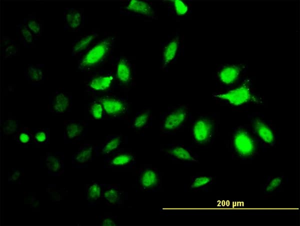 PSMC2 / RPT1 Antibody (clone 4C10-2C8)