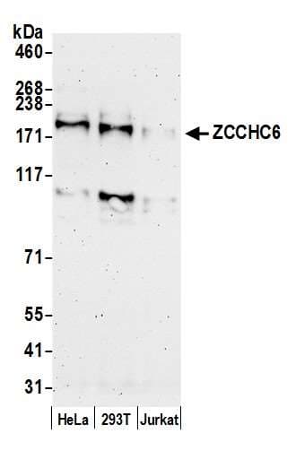 ZCCHC6 Antibody (aa75-125)