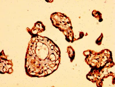 Polyclonal Rabbit anti-Human GPR32 Antibody (IHC, IF, WB)