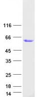 Human GPA33 / A33 Protein (Recombinant Myc-DDK (Flag))