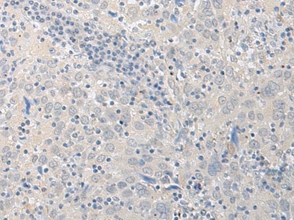 Polyclonal Rabbit anti-Human LYRM2 Antibody (IHC)