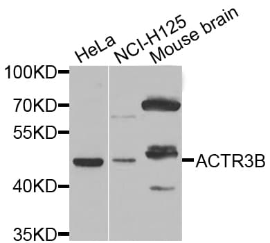 ACTR3B / ARP4 Antibody