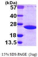Human ARL2 Protein (Recombinant His)