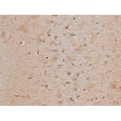 CREB1 / CREB Antibody (phospho-Ser133)
