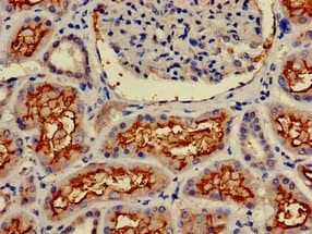 Polyclonal Rabbit anti-Human ANPEP / CD13 Antibody (IHC, IF, WB)