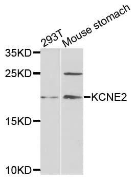 MIRP1 / KCNE2 Antibody