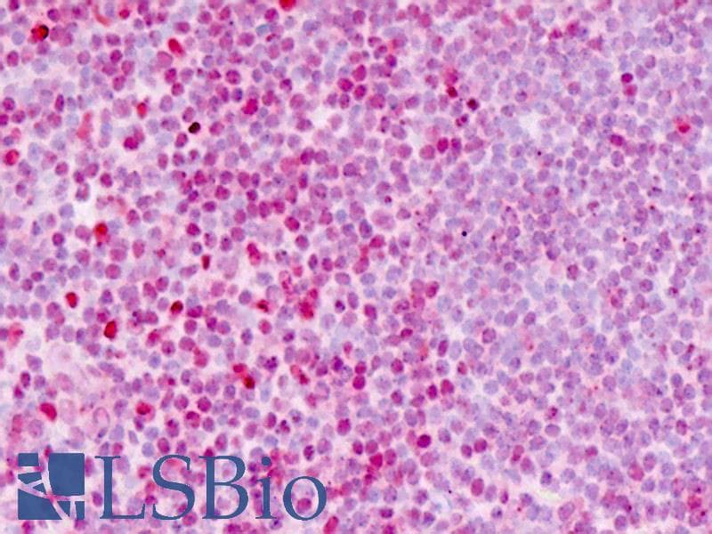 IHC-plus™ TP53 / p53 Antibody (Ser315)