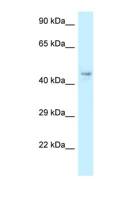 COPS4 / CSN4 Antibody (aa53-102)