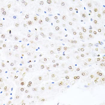 MDM2 Antibody
