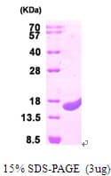 Human CUTA Protein (Recombinant His)