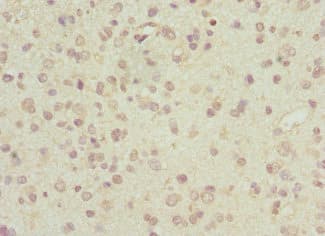 ARL6 Antibody