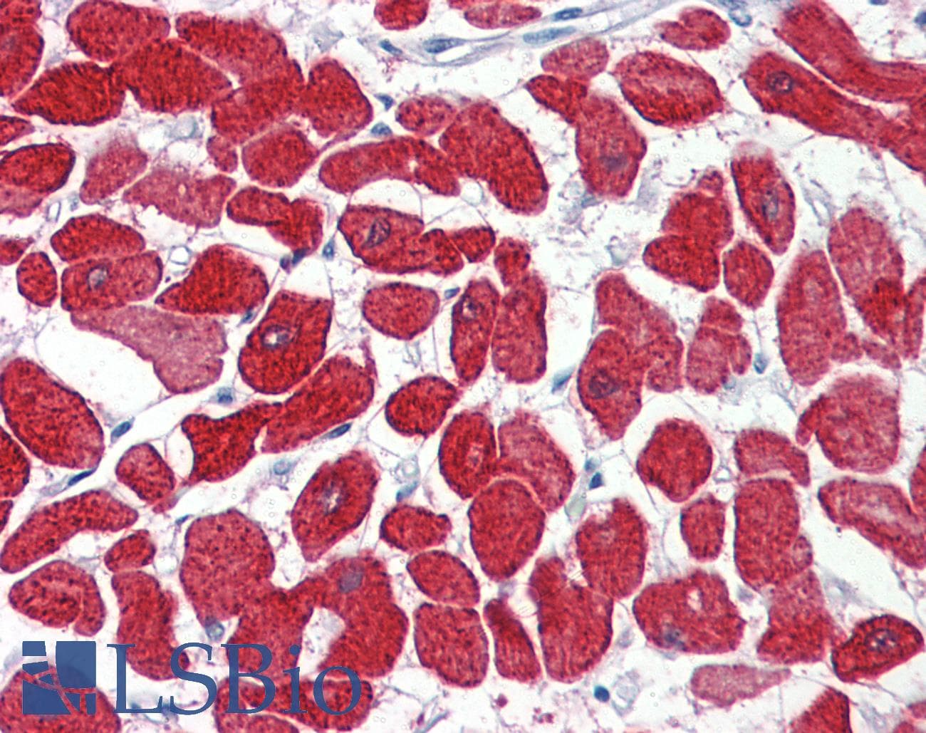 PathPlus™ TNNI3 / Cardiac Troponin I Antibody (aa27-40)