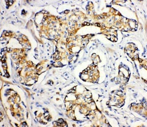 ATP2A2 / SERCA2 Antibody (aa665-679)