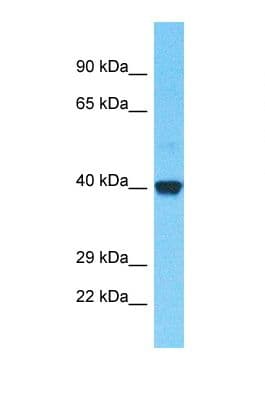 Polyclonal Rabbit anti-Human OR52B2 Antibody (aa211-260, WB)