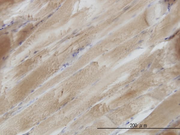 Monoclonal Mouse anti-Human SH3BGR Antibody (clone 3B7, IHC, WB)