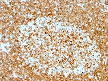 CD74 / CLIP Antibody (clone LN-2 + CLIP/813)
