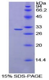 Rat RNH1 Protein (Recombinant His-T7)