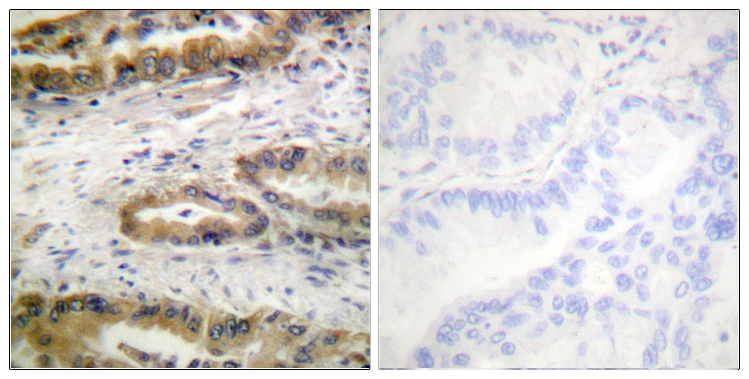 Polyclonal Rabbit anti-Human KDR / VEGFR2 / FLK1 Antibody (phospho-Tyr1054, IHC)