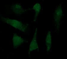LGALS3 / Galectin 3 Antibody (clone OTI1A4, Carrier-free)