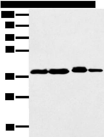 DCX / Doublecortin Antibody