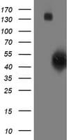 SMS / Spermine Synthase Antibody (clone OTI5F2)