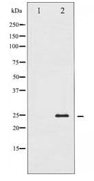 TNNI3 / Cardiac Troponin I Antibody