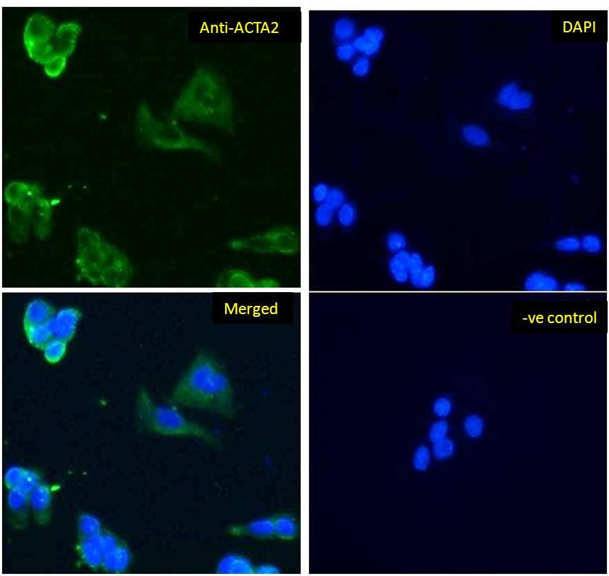 PathPlus™ ACTA2 / Smooth Muscle Actin Antibody (aa1-50)