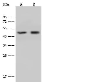 Polyclonal Rabbit anti-Human OTC Antibody (WB)