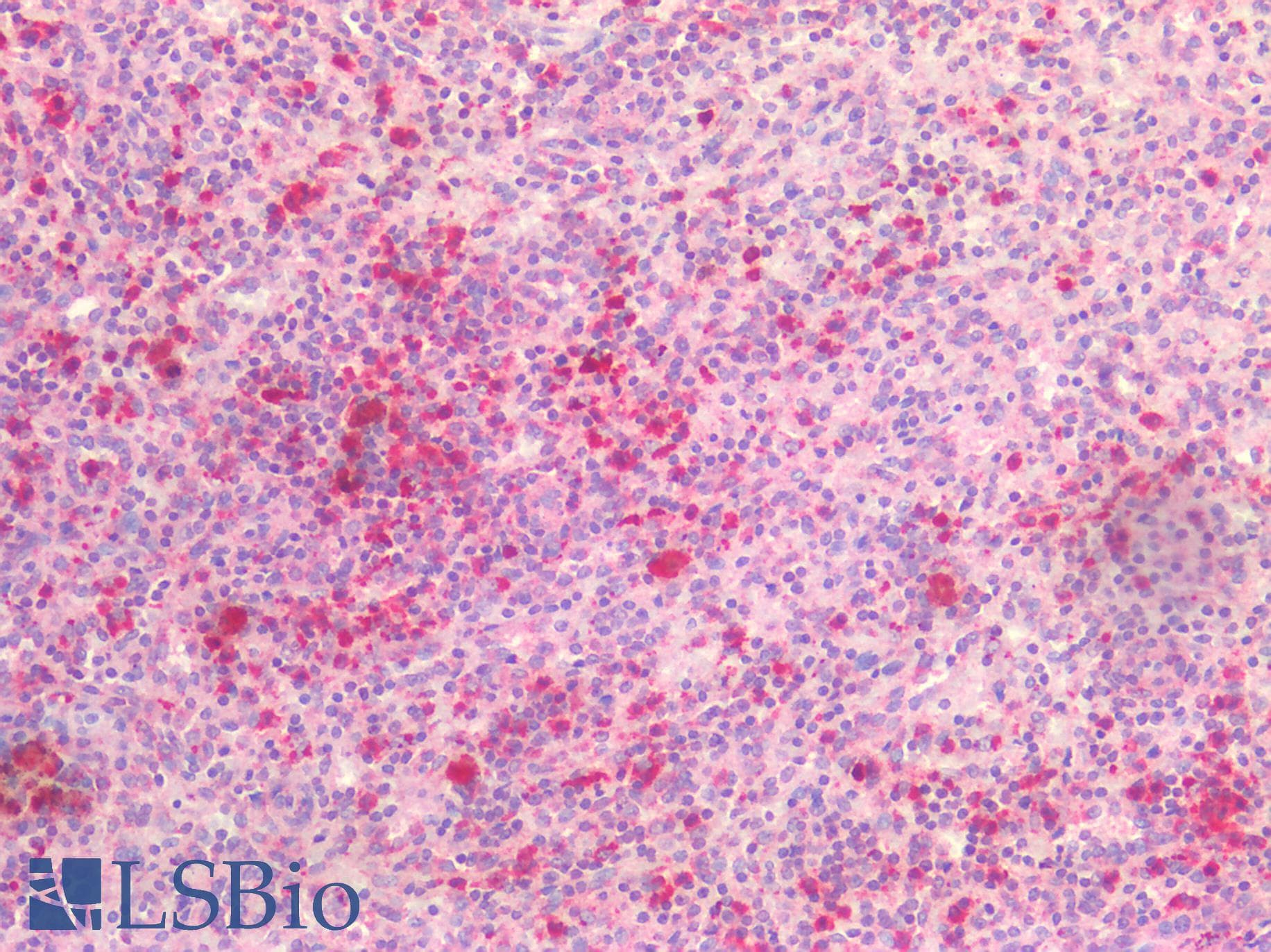 IHC-plus™ IL6R / IL6 Receptor Antibody