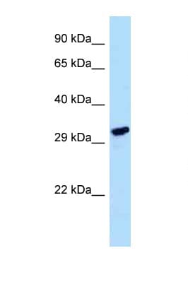 Polyclonal Rabbit anti-Human LDHAL6A Antibody (aa185-234, WB)