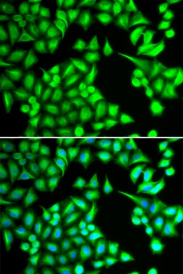 IL21 Antibody