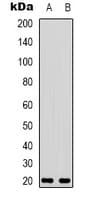 VIP Antibody (Internal)